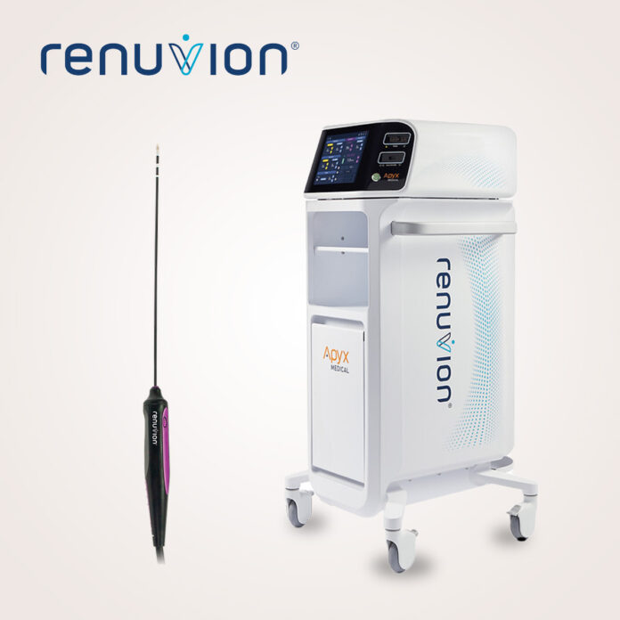 Renuvion® – Informationen auf einen Blick