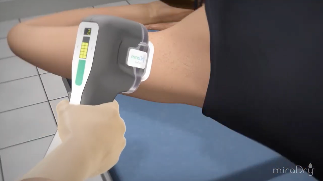 Video zur miraDry Behandlung in Berlin