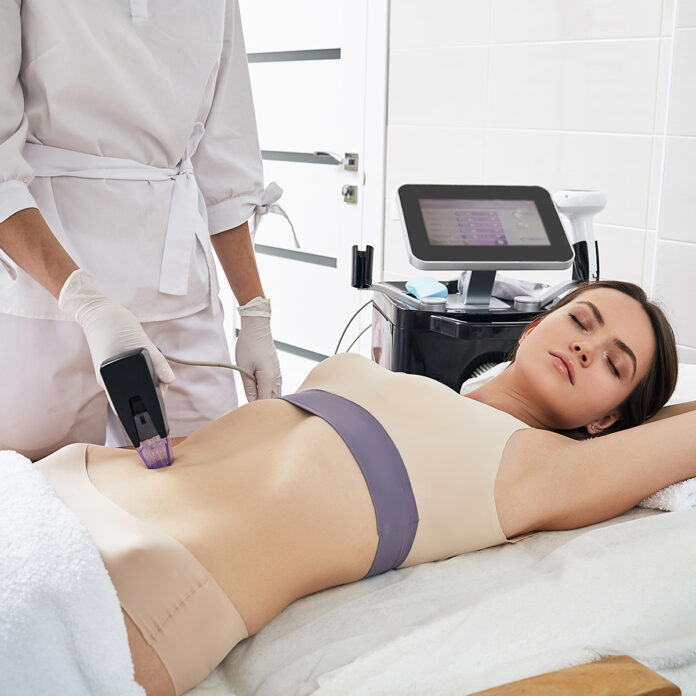 Was ist eine Radiofrequenz-Needling Behandlung mit Morpheus8