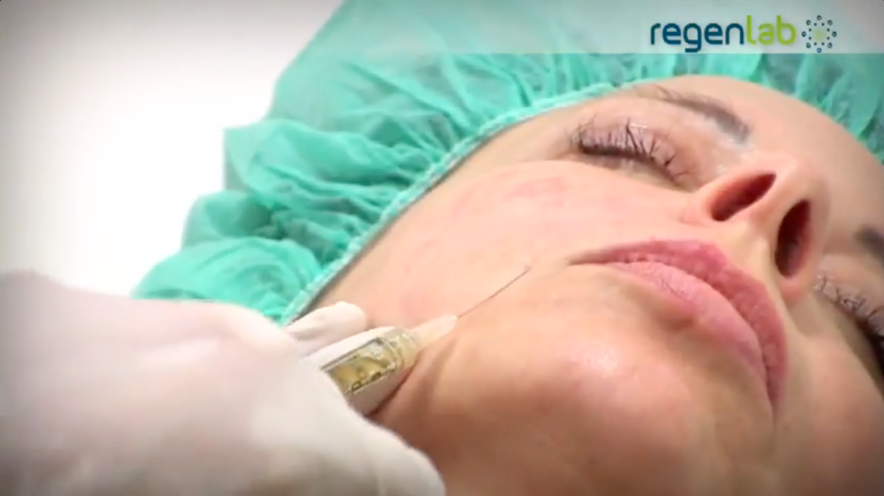 Video zur PRP Behandlung