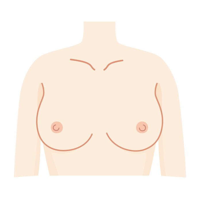 Verschiedene Arten der Brustimplantate