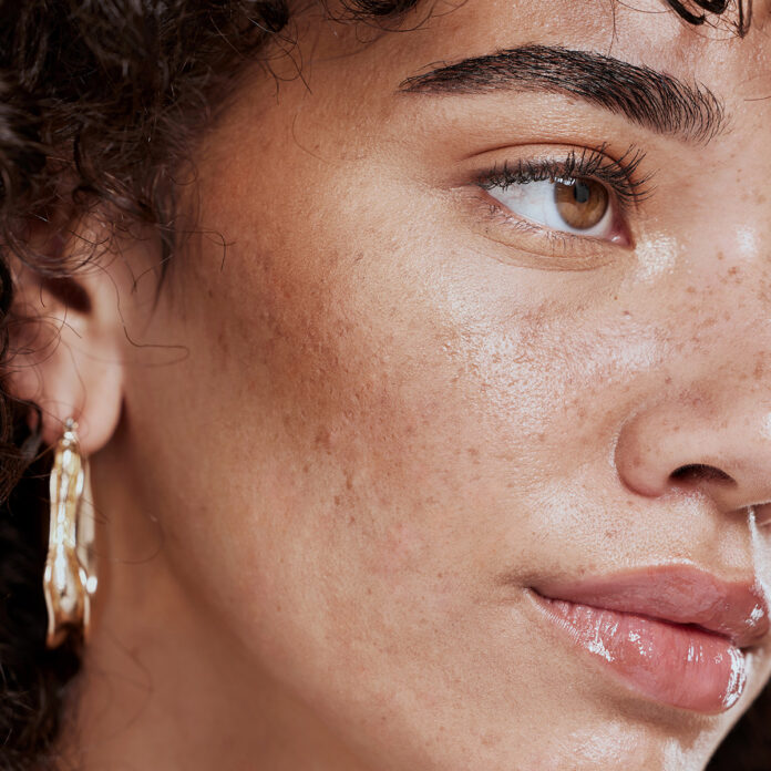 Gründe für eine PRP-Behandlung