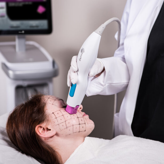 Was versteht man unter einer Thermage FLX Behandlung