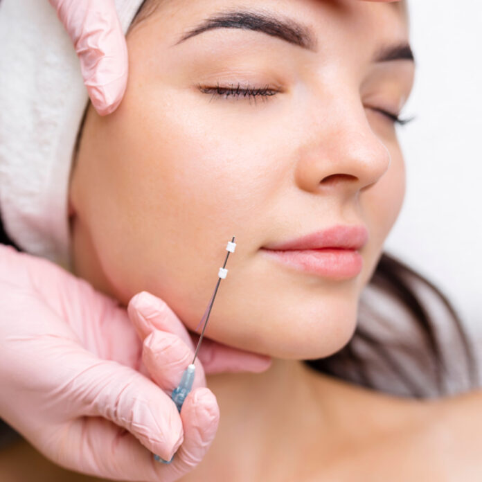 Fadenlifting - Informationen auf einen Blick