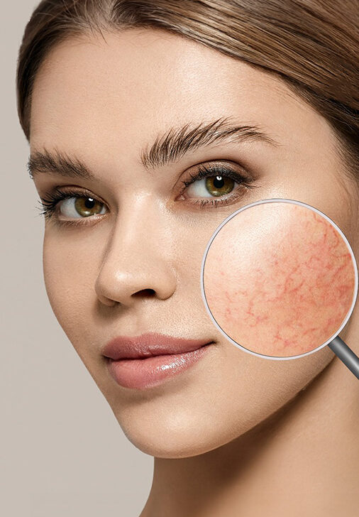 QuadroStarPRO Yellow Behandlung in Berlin