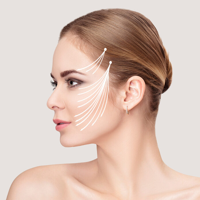 Was ist ein Fadenlifting?