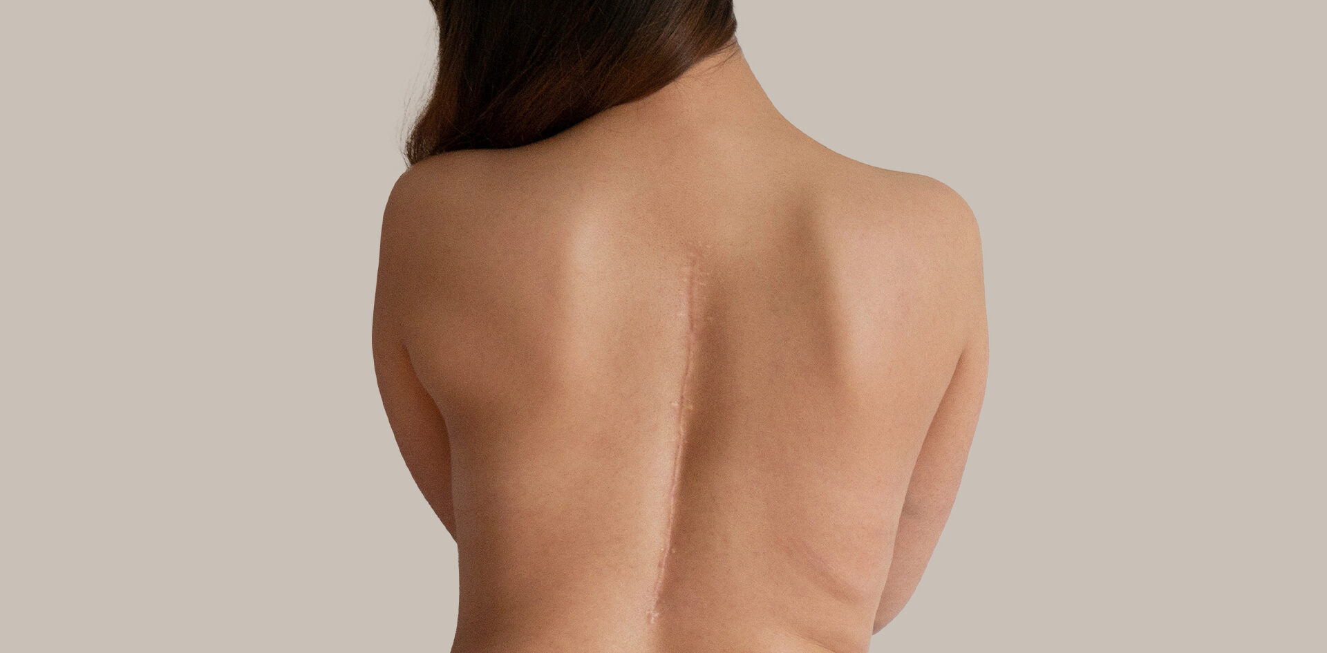 Narbenkorrektur in Berlin