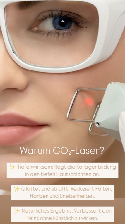 CO2-Laser