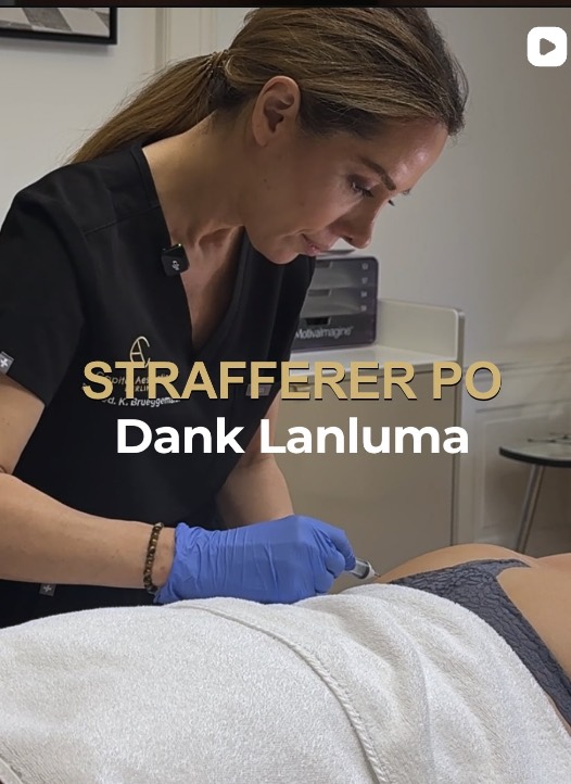 Lanluma
