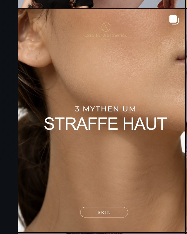 Hautstraffung