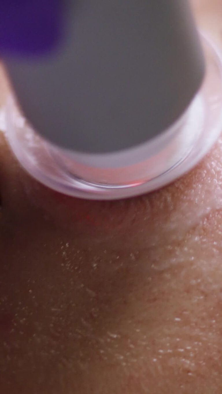 VibroX Anwendung bei einer Préime DermaFacial Behandlung